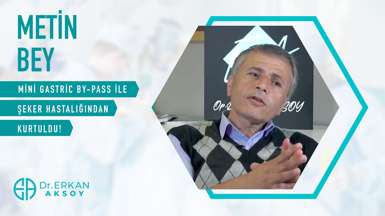Metin Bey | Mini Gastrik Bypass ile Şeker Hastalığından Kurtuldu!