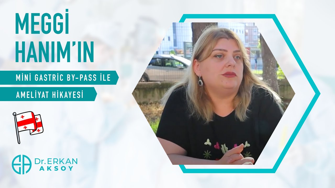 Gürcistan'dan Meggi Hanım Ameliyat Hikayesi | Mini Gastrik Bypass