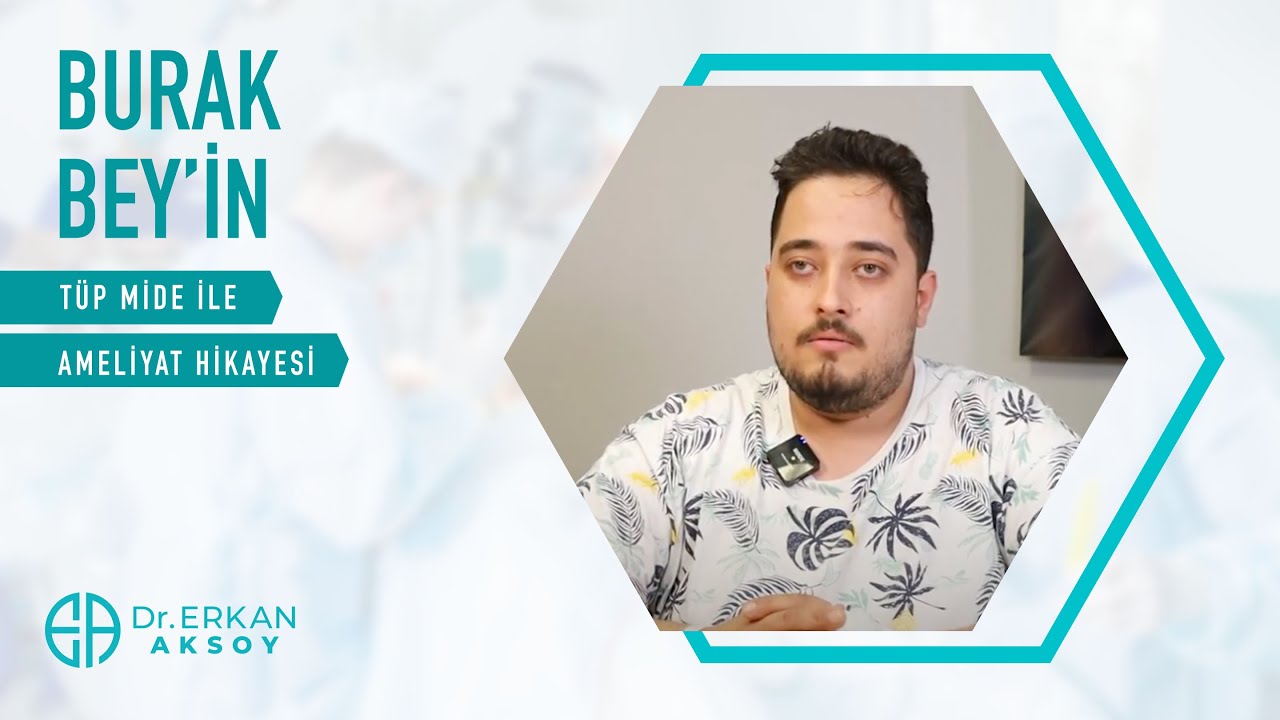 Burak Bey | Tüp Mide Ameliyatı