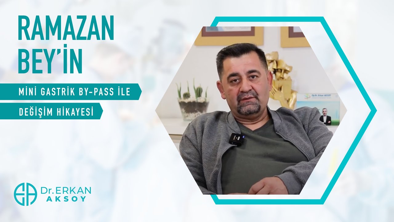 Mi̇ni̇ Gastri̇k Baypass | Ramazan Budak Deği̇şi̇m Hi̇kayesi̇ni̇ Anlatıyor.