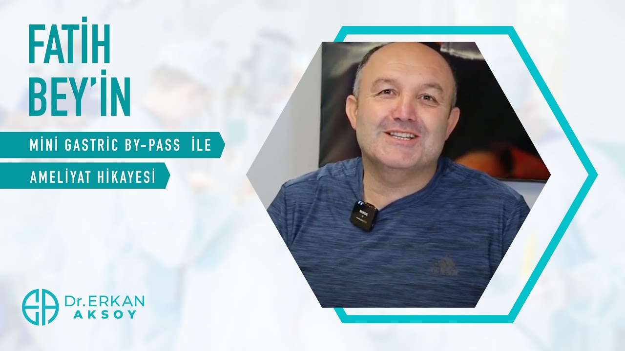 Fatih Bey | Mini Gastrik Bypass Ameliyatı Oldum