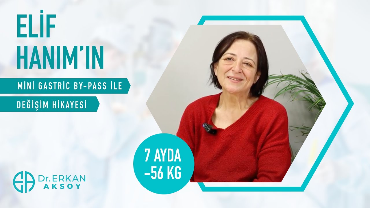 Elif Hanım | Mini Gastrik Bypass | 7 Ayda -56 Kilo Verdi!
