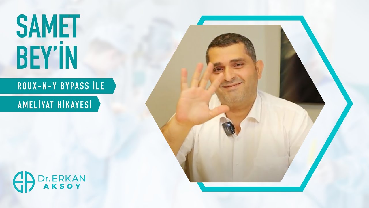 Samet Bey | Roux-n-y Bypass Ameliyatı Oldum